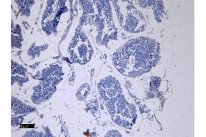 (ABIN7505816) Negative Control showing staining of paraffin embedded Human Testis, with no primary antibody. (ACE2 抗体  (N-Term))