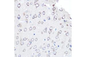 Immunohistochemistry of paraffin-embedded rat brain using [KO Validated] FGF2 Rabbit mAb (ABIN7267184) at dilution of 1:100 (40x lens). (FGF2 抗体)