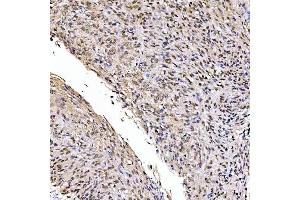 IHC analysis of SSRP1 using anti-SSRP1 antibody (ABIN7600496). (SSRP1 抗体  (AA 2-381))