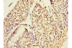 Immunohistochemistry of paraffin-embedded human small intestine tissue using ABIN7155918 at dilution of 1:100 (PLA2G16 抗体  (AA 1-132))