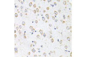 Immunohistochemistry of paraffin-embedded mouse brain using PROK2 antibody (ABIN5975051) at dilution of 1/100 (40x lens). (PROK2 抗体)
