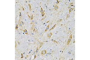 Immunohistochemistry of paraffin-embedded mouse brain using FN1 Antibody (ABIN5975301) at dilution of 1/100 (40x lens). (Fibronectin 1 抗体)
