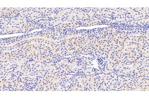 Detection of SIRT3 in Human Kidney Tissue using Polyclonal Antibody to Sirtuin 3 (SIRT3) (SIRT3 抗体  (AA 126-399))