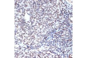 Immunohistochemistry of paraffin-embedded rat ovary using SUN2 Rabbit mAb (ABIN7270135) at dilution of 1:100 (40x lens). (SUN2 抗体)