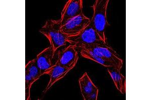 Immunofluorescence analysis of Hela cells using BMP4 mouse mAb.