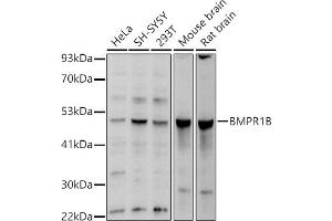 Western Blotting (WB) image for anti-Bone Morphogenetic Protein Receptor, Type IB (BMPR1B) (AA 1-126) antibody (ABIN3022720)