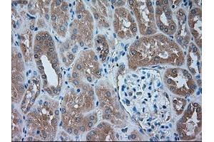Immunohistochemical staining of paraffin-embedded liver tissue using anti-SERPINA1mouse monoclonal antibody. (SERPINA1 抗体)