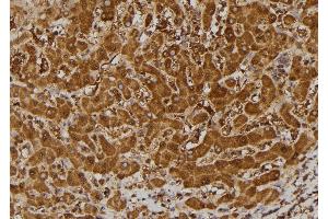 ABIN6269334 at 1/100 staining Human liver tissue by IHC-P. (BCL2L1 抗体  (N-Term))