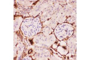 Anti-P Glycoprotein Picoband antibody,  IHC(P): Mouse Kidney Tissue (ABCB1 抗体  (Middle Region))