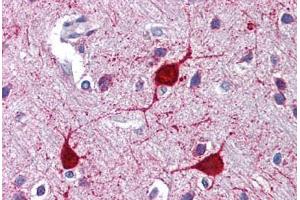 Human Brain, Cortex: Formalin-Fixed, Paraffin-Embedded (FFPE) (LYVE1 抗体  (N-Term))