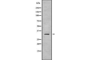 Western blot analysis of MRPL19 using Jurkat whole cell lysates (MRPL19 抗体  (Internal Region))