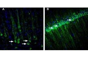 Immunohistochemistry (IHC) image for anti-Receptor (G Protein-Coupled) Activity Modifying Protein 1 (RAMP1) (AA 27-38), (Extracellular) antibody (ABIN7043595)