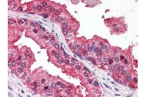 Image no. 1 for anti-DNA-Damage Regulated Autophagy Modulator 1 (DRAM1) (N-Term) antibody (ABIN372925) (DRAM 抗体  (N-Term))