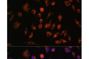 Immunofluorescence analysis of L929 cells using TRIM4 Polyclonal Antibody at dilution of 1:100. (TRIM4 抗体)