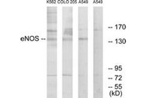 Western Blotting (WB) image for anti-Nitric Oxide Synthase 3 (Endothelial Cell) (NOS3) (AA 1145-1194) antibody (ABIN2888911) (ENOS 抗体  (AA 1145-1194))