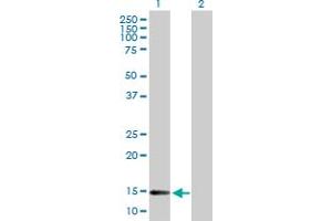 Western Blot analysis of DNAJC19 expression in transfected 293T cell line by DNAJC19 MaxPab polyclonal antibody. (DNAJC19 抗体  (AA 1-116))