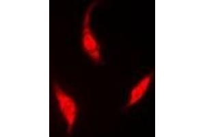 Immunofluorescent analysis of HIWI2 staining in A549 cells. (PIWIL4 抗体)