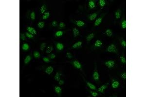 IF analysis of Pin1 using anti-Pin1 antibody (ABIN7599020).