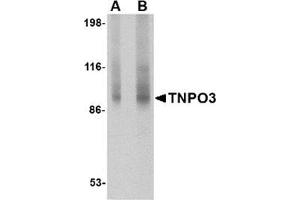 Western blot analysis of TNPO3 in rat liver tissue lysate with TNPO3 antibody at (A) 1 and (B) 2 μg/ml. (Transportin 3 抗体  (N-Term))