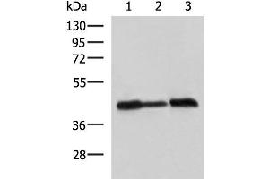 Western blot analysis of A549 Hela and HepG2 cell lysates using PDHA1 Polyclonal Antibody at dilution of 1:750 (PDHA1 抗体)