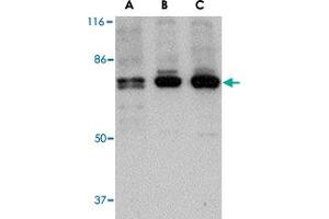 Western blot analysis of PTK7 in (A) human, (B) mouse and (C) rat colon tissue lysate with PTK7 polyclonal antibody  at 1 ug/mL . (PTK7 抗体  (N-Term))