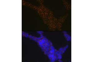 Immunofluorescence analysis of Jurkat cells using LSP1 Rabbit mAb (ABIN7268319) at dilution of 1:100 (40x lens). (LSP1 抗体)