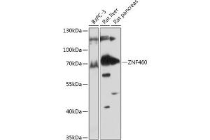 Western blot analysis of extracts of various cell lines, using ZNF460 antibody (ABIN7271490) at 1:1000 dilution. (ZNF460 抗体  (AA 100-210))
