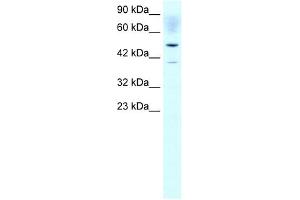 ACAT2 antibody used at 1 ug/ml to detect target protein. (ACAT2 抗体)