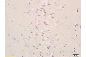 Immunohistochemistry (Paraffin-embedded Sections) (IHC (p)) image for anti-Galactosylceramidase (GALC) (AA 301-400) antibody (ABIN708101)