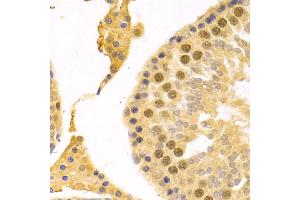 Immunohistochemistry of paraffin-embedded rat testis using RFC4 Antibody (ABIN5973195) at dilution of 1/100 (40x lens). (RFC4 抗体)