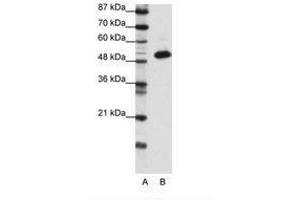 Image no. 1 for anti-Transcriptional Adaptor 3 (TADA3) (N-Term) antibody (ABIN6736139) (TADA3L 抗体  (N-Term))