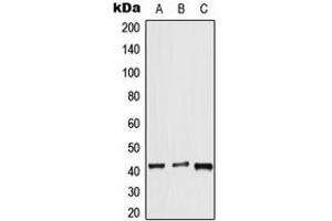 Western blot analysis of APJ expression in HeLa (A), mouse lung (B), rat liver (C) whole cell lysates. (Apelin Receptor 抗体  (Center))
