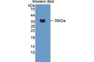 Western blot analysis of the recombinant protein. (TPSB2 抗体  (AA 30-276))