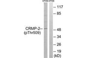 Western blot analysis of extracts from HT29 cells treated with heat shock, using CRMP-2 (Phospho-Thr509) Antibody.