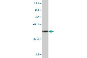 Western Blot detection against Immunogen (36. (CAMKK1 抗体  (AA 2-100))