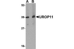 Western blot analysis of UROP11 in mouse spleen tissue lysate with this product at (A) 1 and (B) 2 μg/ml. (APBA1 抗体  (Center))