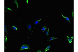 Immunofluorescent analysis of Hela cells using ABIN7154826 at dilution of 1:100 and Alexa Fluor 488-congugated AffiniPure Goat Anti-Rabbit IgG(H+L) (TSC1 抗体  (AA 101-344))