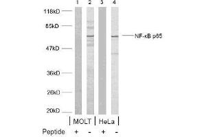 Image no. 1 for anti-Nuclear Factor-kB p65 (NFkBP65) (Ser468) antibody (ABIN197115) (NF-kB p65 抗体  (Ser468))