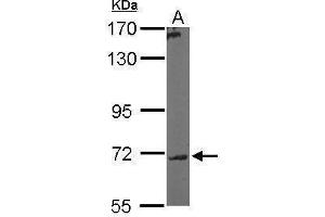 Western Blotting (WB) image for anti-UDP-N-Acetyl-alpha-D-Galactosamine:polypeptide N-Acetylgalactosaminyltransferase 7 (GalNAc-T7) (GALNT7) (Center) antibody (ABIN2856251)