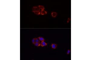 Immunofluorescence analysis of HepG2 cells using Perilipin-2 antibody (ABIN7269220) at dilution of 1:100 (40x lens). (ADRP 抗体)