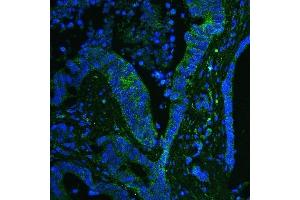 IF analysis of GPX1 using anti-GPX1 antibody (ABIN6719520).