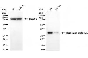 Western blotting analysis using replication protein A2 antibody (ABIN7800174).