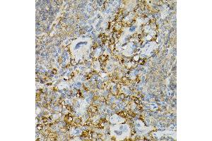 Immunohistochemistry (IHC) image for anti-Mast/stem Cell Growth Factor Receptor (KIT) (AA 25-295) antibody (ABIN6142896)
