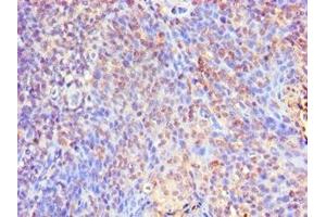 Immunohistochemistry (IHC) image for anti-SMAD Family Member 9 (SMAD9) (AA 1-300) antibody (ABIN7160251)