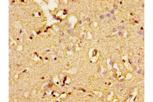 Immunohistochemistry of paraffin-embedded human brain tissue using ABIN7143338 at dilution of 1:100 (ADCY8 抗体  (AA 534-670))