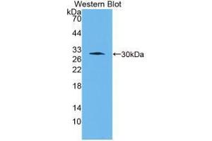 Western blot analysis of recombinant Human CTSK. (Cathepsin K 抗体  (AA 115-329))