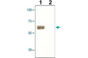 The whole cell lysate derived from LNCaP was immunoblotted by SOX9 polyclonal antibody  at 1 : 500 (Lane 1), Lane 2 is a negative control. (SOX9 抗体)