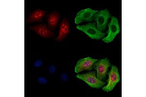 ABIN6255667 and ABIN6267591 staining Hela cells(4h of LPS treatment) by IF/ICC. (MEF2A 抗体  (pThr319))