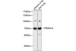 Western blot analysis of extracts of various cell lines, using PRDM14 antibody (ABIN6128495, ABIN6146132, ABIN6146135 and ABIN6217736) at 1:1000 dilution. (PRDM14 抗体  (AA 1-260))