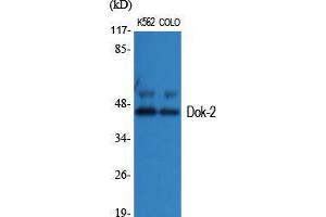 Western Blot (WB) analysis of specific cells using Dok-2 Polyclonal Antibody. (DOK2 抗体  (Tyr419))